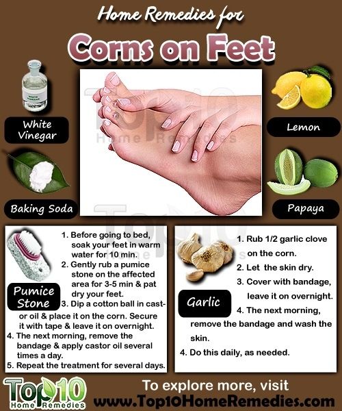 feet treatment at home feet treatment at home