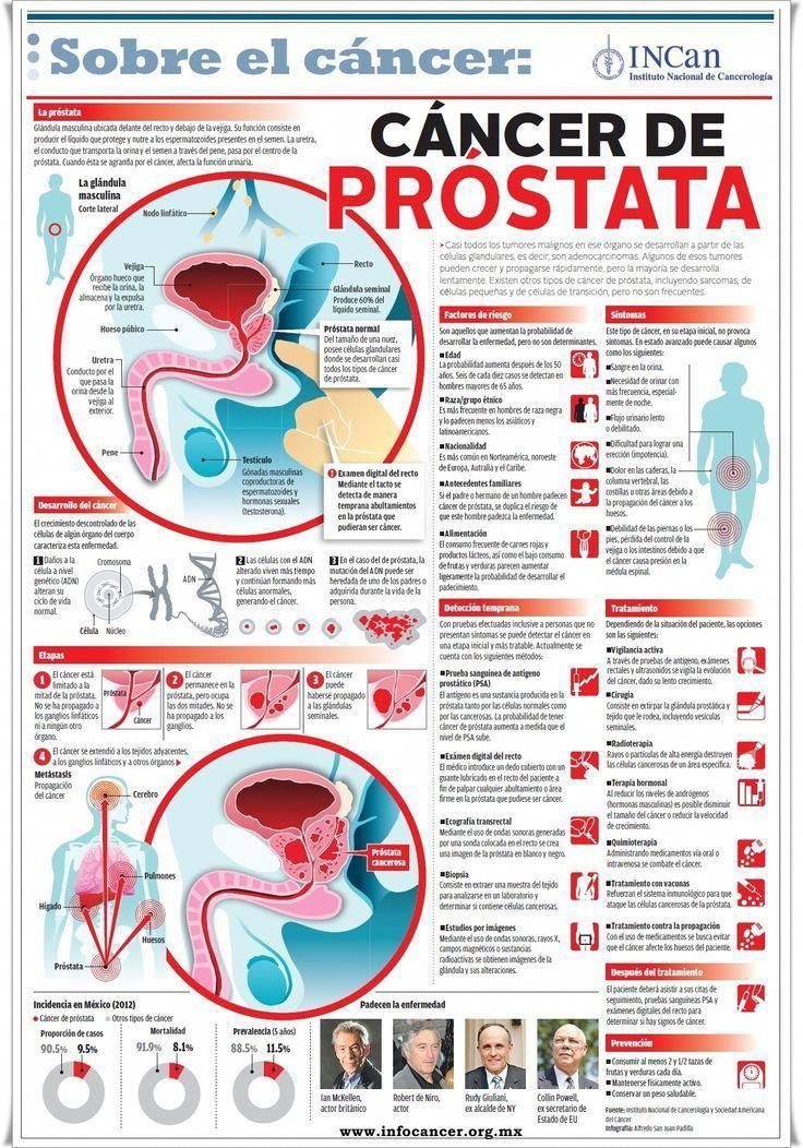 el chocolate hace daño para la prostata