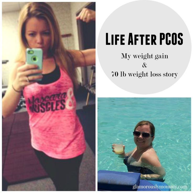 Levothyroxine Weight Loss Success Stories