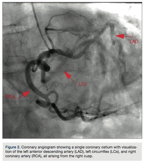 Best 25+ Cath lab nurse ideas on Pinterest Ekg leads, Critical - cath lab nurse sample resume Best 25+ Cath lab nurse ideas on Pinterest Ekg leads, Critical - cath lab nurse sample resume