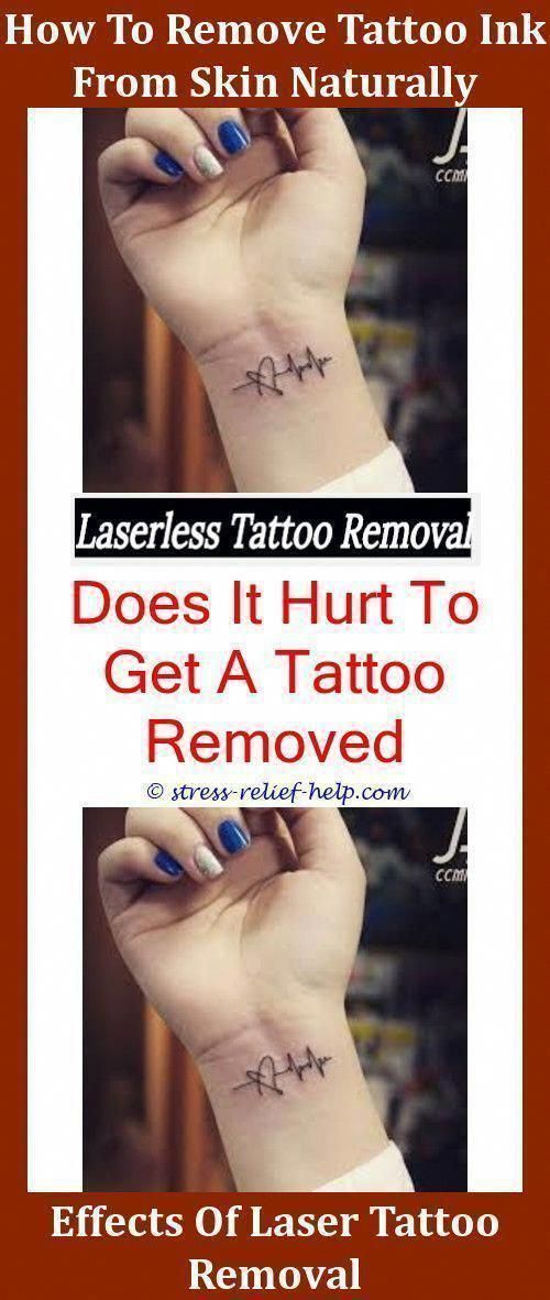 Haupttätowierungs-Abbau-Werkzeuge Ruining Balm Tattoo Removal Cream ..., #Balm #cream #diyta...