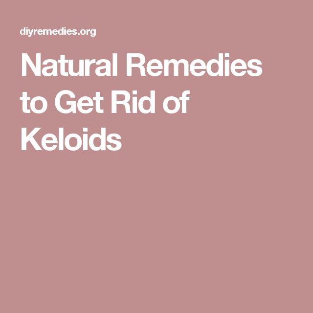 Natural Remedy For Keloids On Ear Natural Remedy For Keloids On Ear
