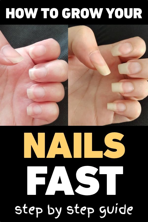 How To Grow Your Nails Fast Step By Step Guide You Nailed It Nails How To Grow Nails