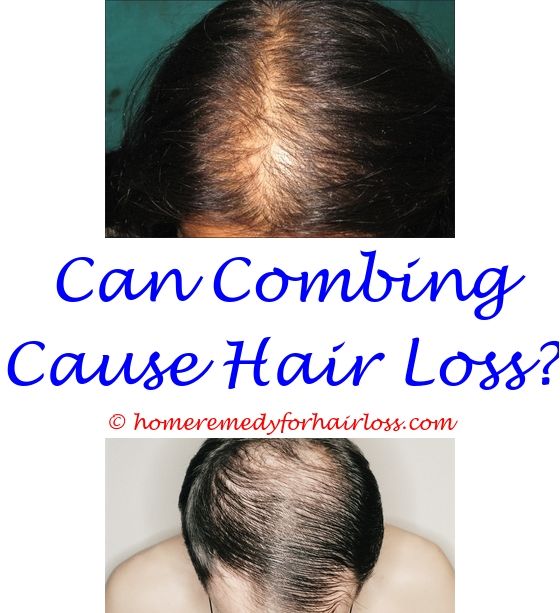 Can Fleas Cause Hair Loss Above Cat S Eye Can Fleas Cause Hair Loss Above Cat S Eye