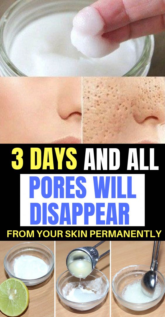 Apple cider vinegar a powerful skin lotion Mix a tablespoon of ACV