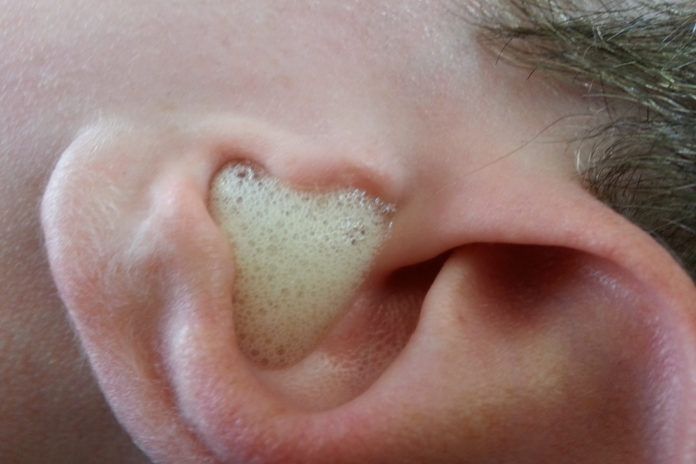 Can You Use Peroxide In Your Ear 19 Home Remedies You Won T Believe Actually Work Health Remedies Natural Health Remedies Sick Remedies
