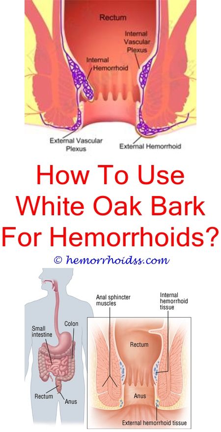vaginal hemmoroid pics Girls with shemales in restroom