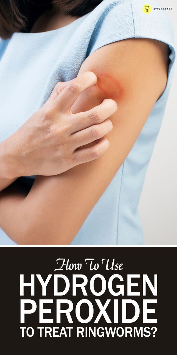 Slideshow Skin Problems In Cats Cat Skin Cat Skin Problems