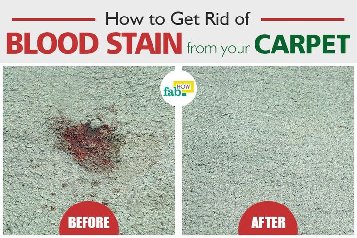 how to get blood out of carpet with vinegar