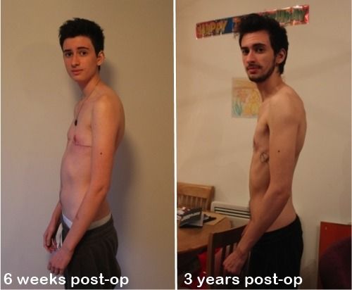 alternativ hormone treatment for transgender gay bars niagara