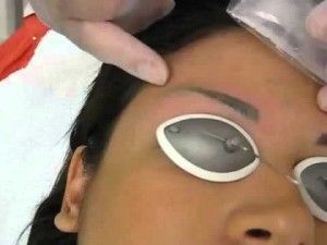 les 25 meilleures idées de la catégorie enlèvement de tatouage de les 25 meilleures idées de la catégorie enlèvement de tatouage de