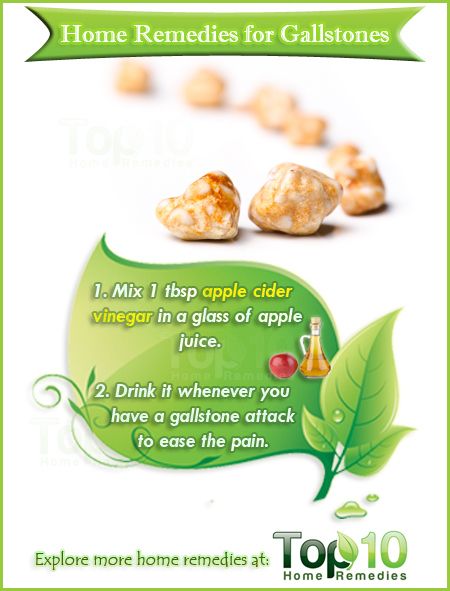 Home Remedies Treating Gallstones Naturally Home Remedies Treating Gallstones Naturally