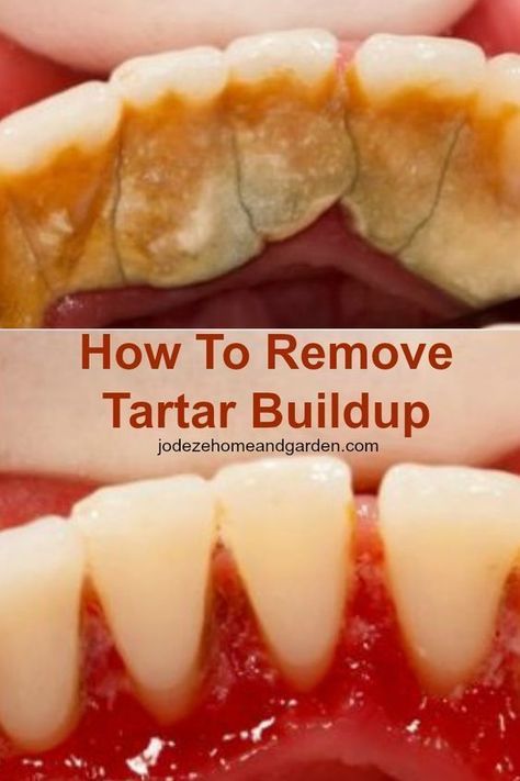 Natural Dog Tartar Removal Recipe Natural Dog Tartar Removal Recipe