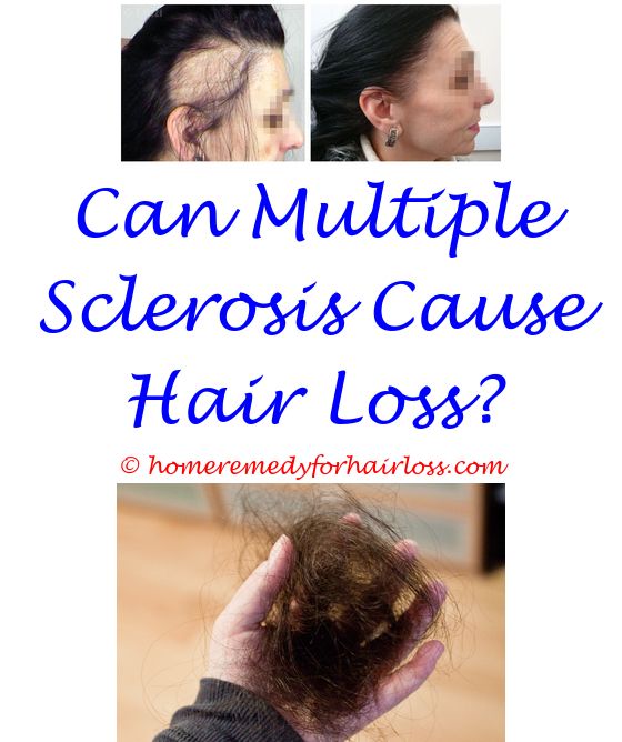 14 best Stop Hair Loss images on Pinterest