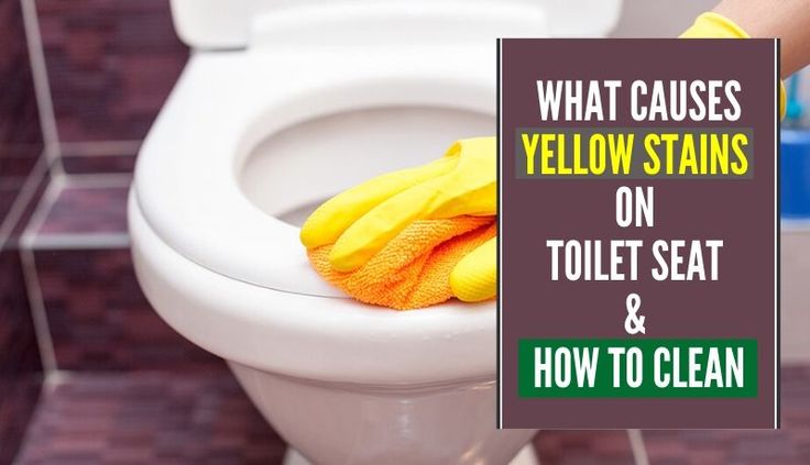What Causes Yellow Stains On Toilet Seat 038 How To Clean In 2021 Cleaning - How To Remove Yellow Stains From Toilet Seat Cover What Causes Yellow Stains On Toilet Seat 038 How To Clean In 2021 Cleaning - How To Remove Yellow Stains From Toilet Seat Cover