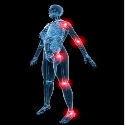 Natural Remedies For Psoriatic Arthritis Natural Remedies For Psoriatic Arthritis
