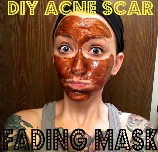 Hot thong girls panty teen Facial laceration scar fading