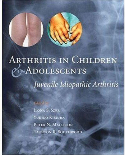 Arthritis medication pediatric