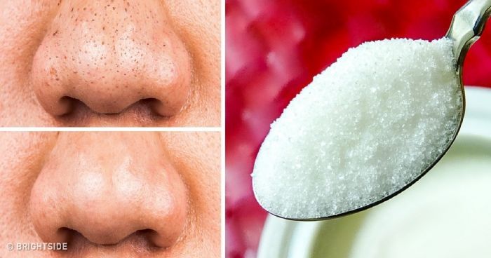Retinol szérum | ráncellenes anti-aging programhoz