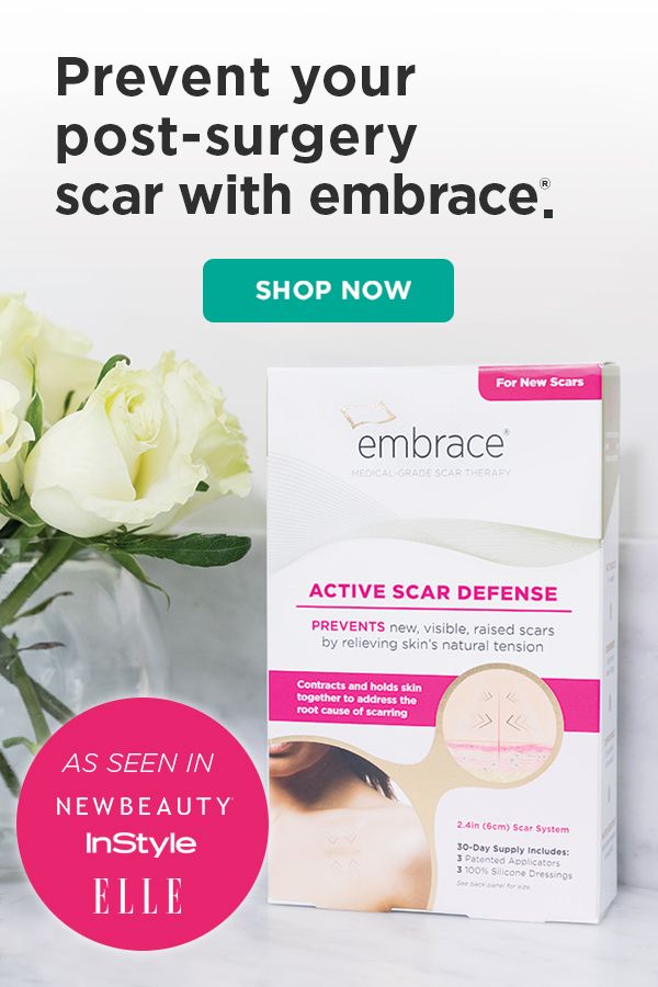 embrace scar scar revision have lighter thinner flatter scars after surgery with the unique scar prevention technology of embrace scar therapy save 20 off for limited time embrace scar scar revision have lighter thinner flatter scars after surgery with the unique scar prevention technology of embrace scar therapy save 20 off for limited time