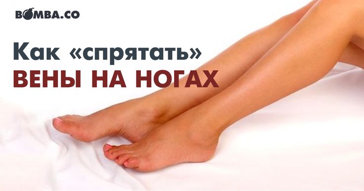 Аюрведа как лечить варикоз