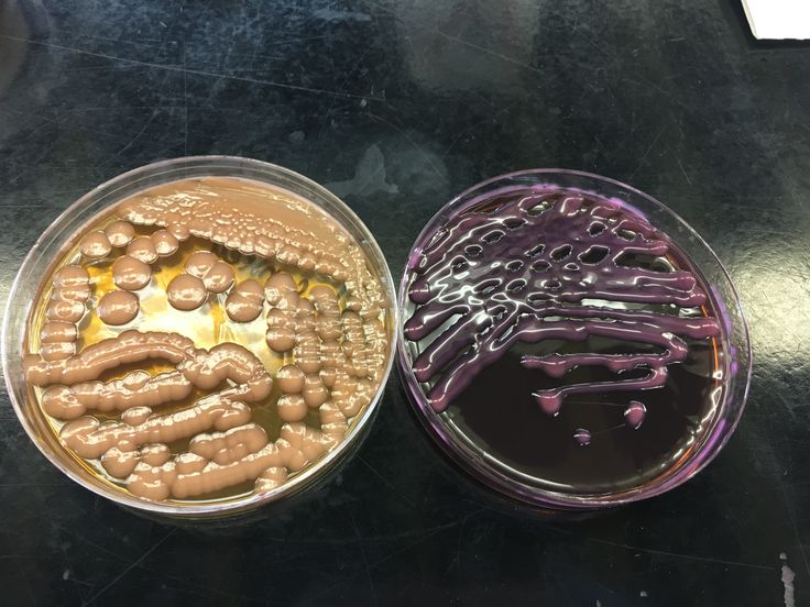 Bacillus cereus emb