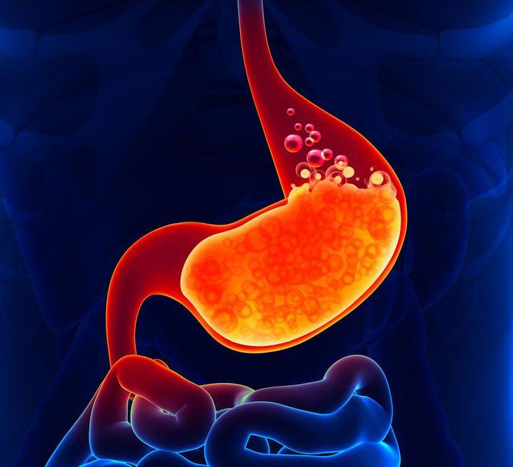 home remedies for chest pain due to acid reflux