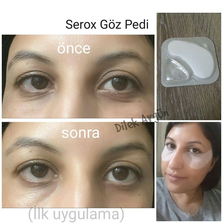 Dilek Aygun Adli Kullanicinin Lr Health Beauty Panosundaki Pin Dilek Aygun Adli Kullanicinin Lr Health Beauty Panosundaki Pin