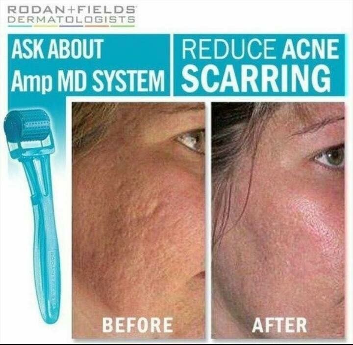 Rodan + Fields Skincare Review with FREE Mini Facial ...