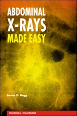 ABDOMINAL X RAY MADE EASY PDF