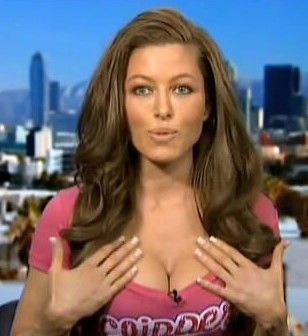 Enlarged vein in the vulva Chan noode chubbies