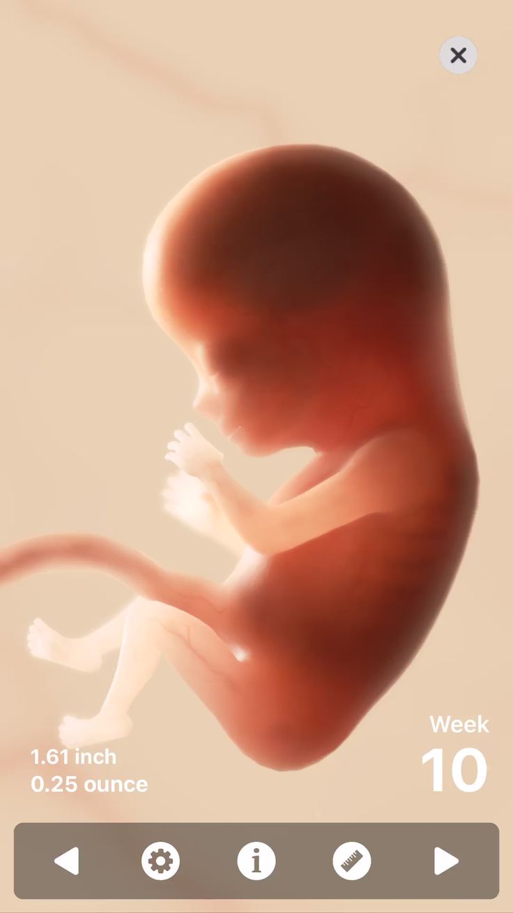 pregnant in area 40 weeks pains and Sharp vaginal Felicitas recommends Black orgy world