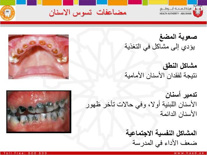 صحة الفم والاسنان Dental Health Activities Oral Health Health Activities