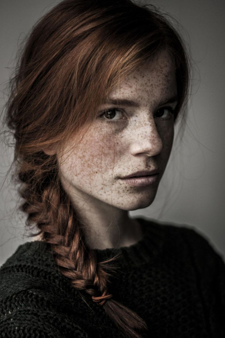 Freckled girls