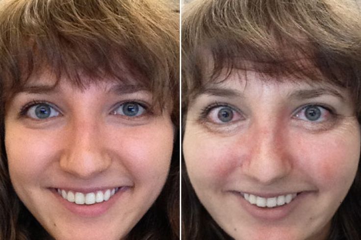 59 Before & After Pics That Show What Happens When You Stop Drinking Quitting al