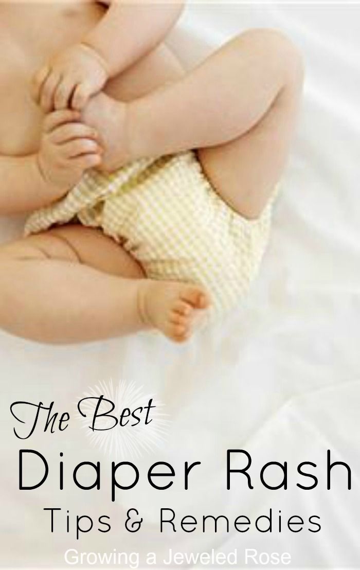 Natural Diaper Rash Remedy Baking Soda Natural Diaper Rash Remedy Baking Soda