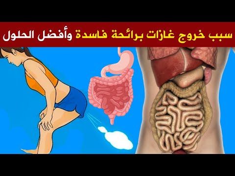 سبب غريب لخروج غازات برائحة كريهة علاج غازات البطن بوصفات طبيعية وتنظيف الجسم من البراز المتحجر حالا Youtube In 2021