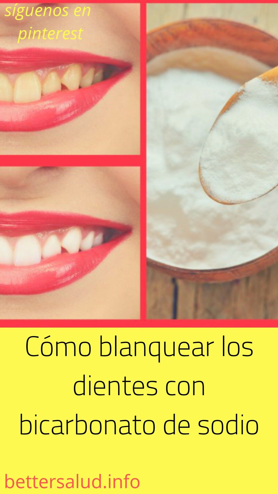 como blanquear los dientes con bicarbonato de sodio como blanquear los dientes con bicarbonato de sodio