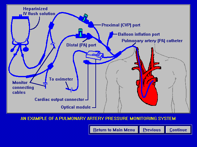 hemodynamic monitoring hemodynamic monitoring part i waveform hemodynamic monitoring