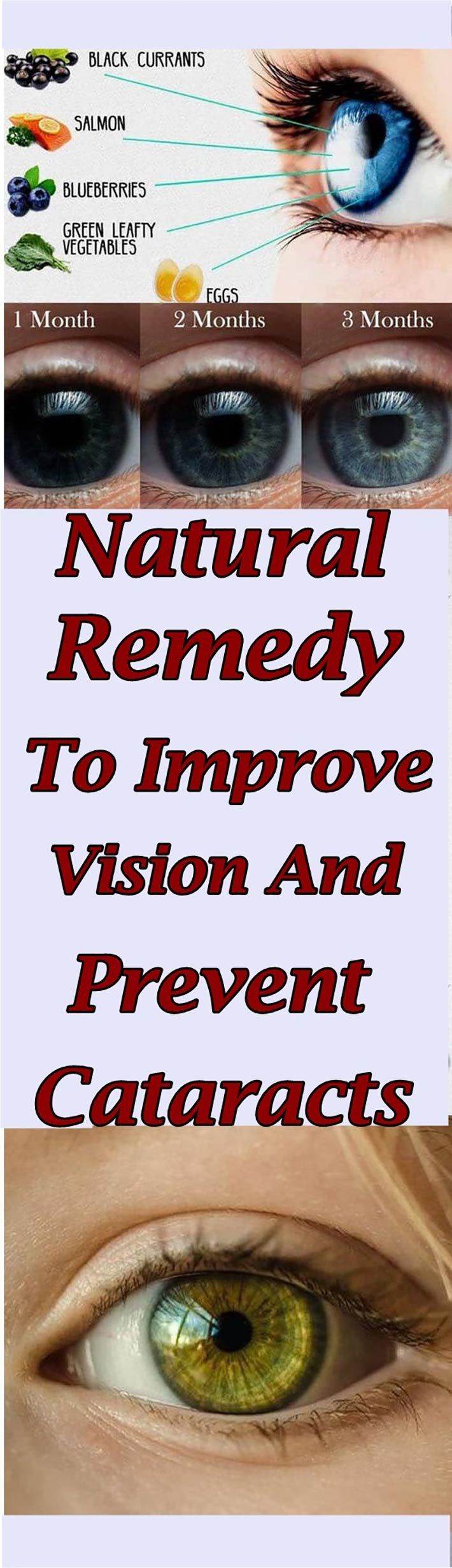 Natural Remedy To Improve Vision And Prevent Cataracts #health #eyes #cataracts Natural Cold Remedies, Cold Home Remedies, Natural Remedies For Anxiety, Cough Remedies, Holistic Remedies, Health Remedies, Herbal Remedies, Sleep Remedies, Skin Remedies