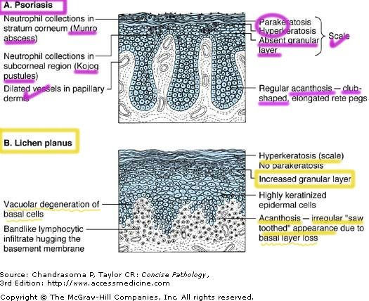 proteus vulgaris behandling proteus vulgaris behandling
