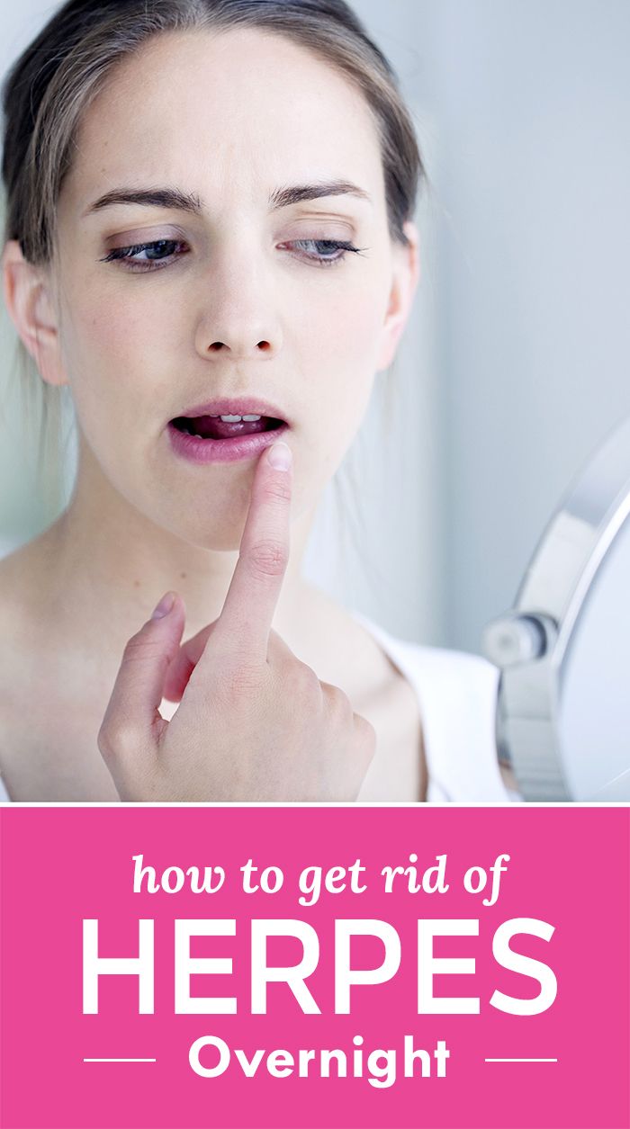 Best pill for menstrual cramps How to get rid of genital herpes on lips fast