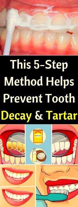 This 5-Step, Method, Helps Prevent, Tooth, Decay & Tartar!!! #life_style #fitness
