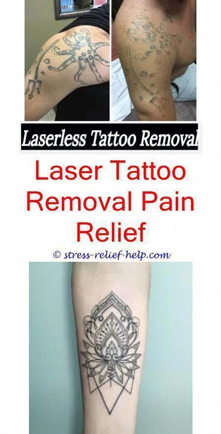 Does laser tattoo removal work 100.How to remove eyebrow ...