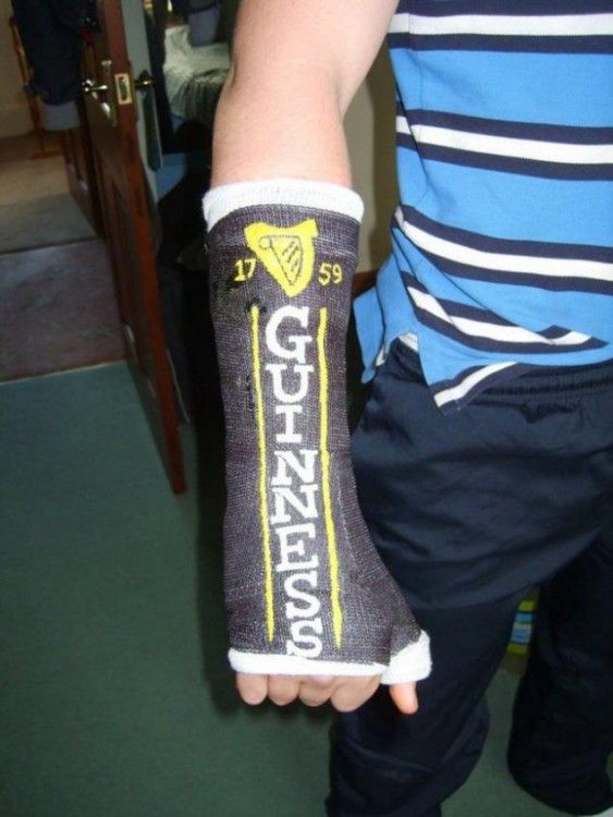 17 Ideas De Yeso Pintado Yeso Yeso En El Brazo Brazo Enyesado