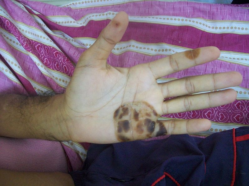 Pin En Medicina