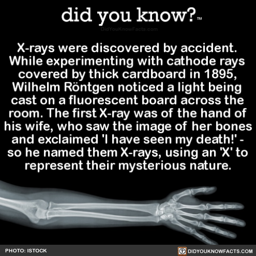 did-you-kno: X-rays were discovered by accident.... - The Lovely