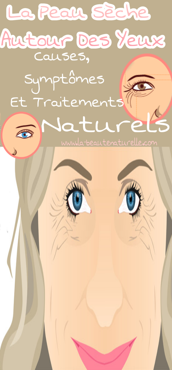 peau vaseline autour des yeux peau vaseline autour des yeux