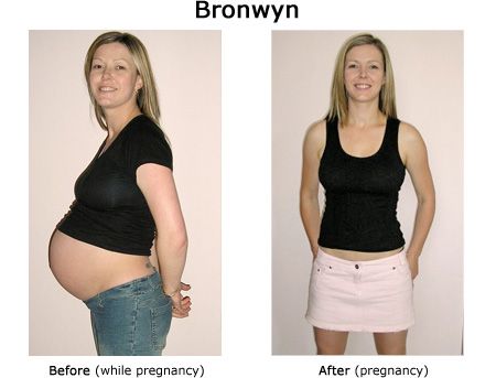 C section weight loss photo 9