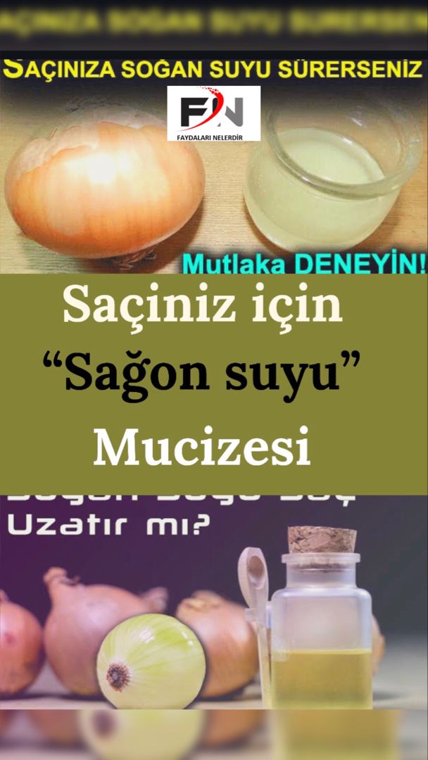 Sogan Suyunun Saca Faydalari Faydalari Nelerdir Dogal Sac Bakimi Sac Dogal Sac Sogan Suyunun Saca Faydalari Faydalari Nelerdir Dogal Sac Bakimi Sac Dogal Sac